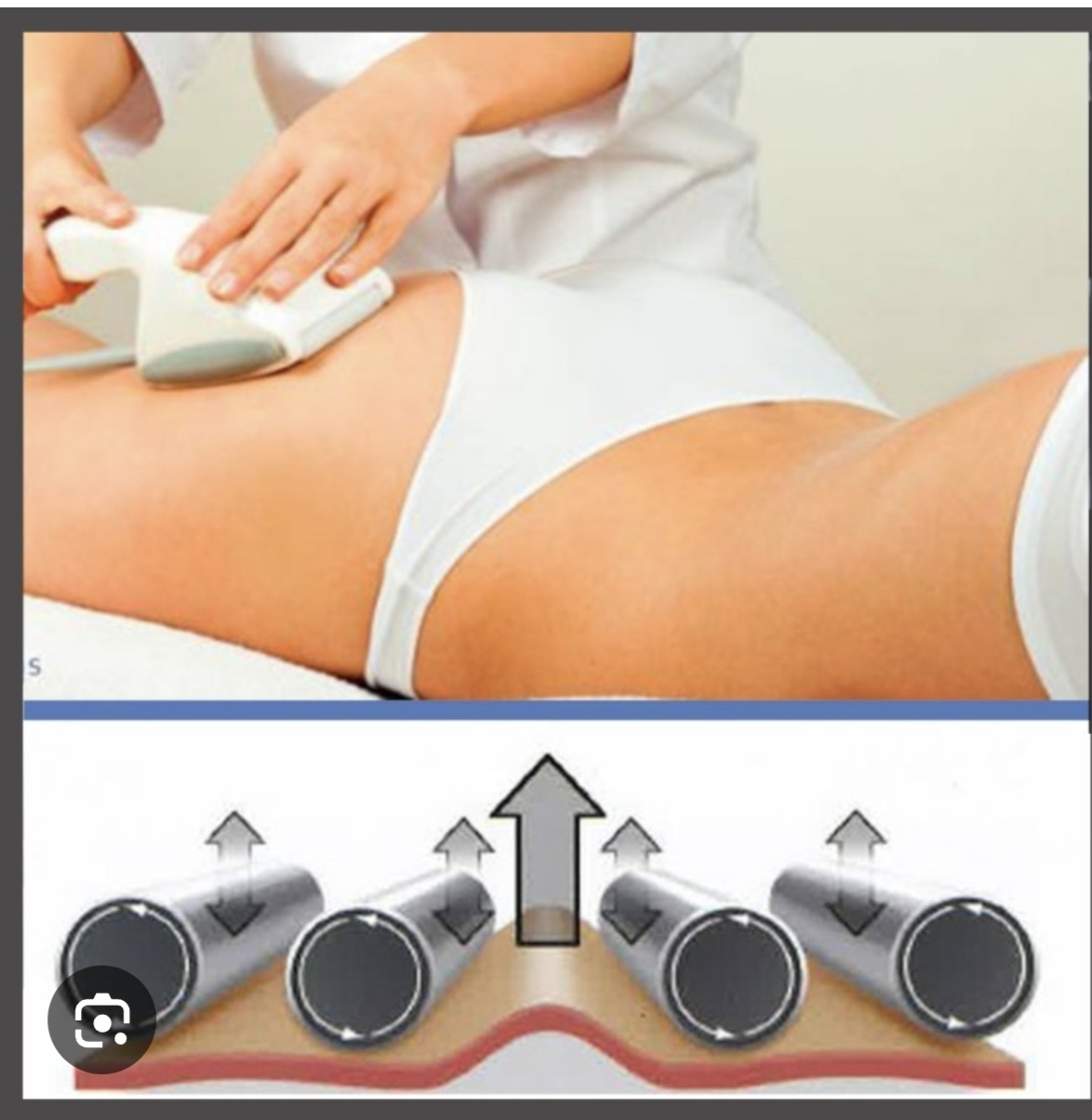 MASSAGGIO ENDODERMICO – VACUUM